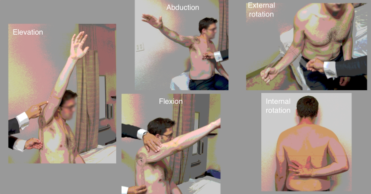 3 Clinician assessing shoulder flexion, abduction and external rotation
